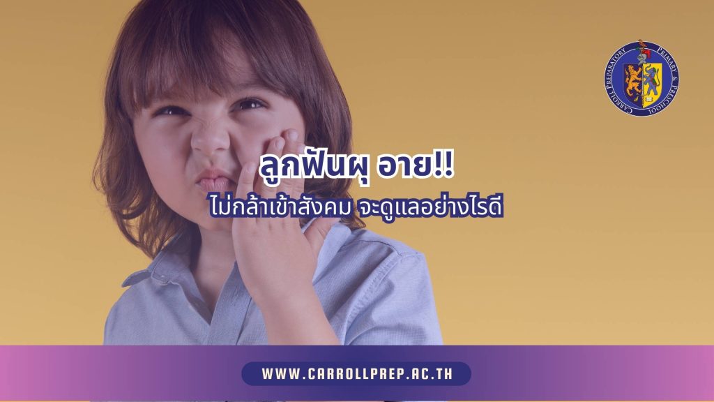 ลูกฟันผุ อายไม่กล้าเข้าสังคม จะดูแลอย่างไรดี 1 Child with tooth decay